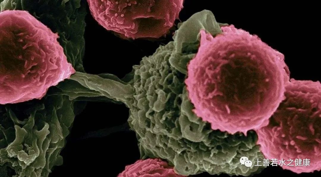 NK细胞诱导癌细胞凋亡