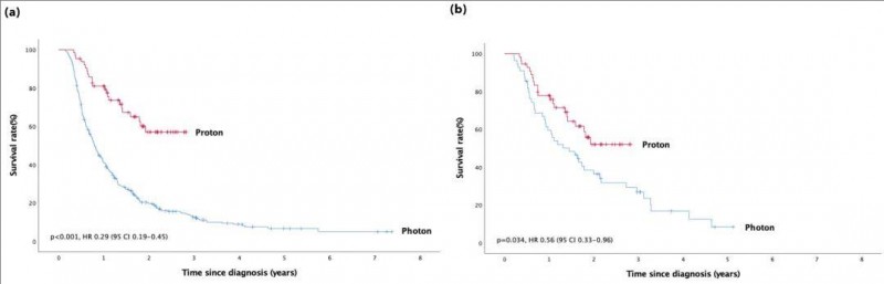 质子治疗肝癌的生存获益