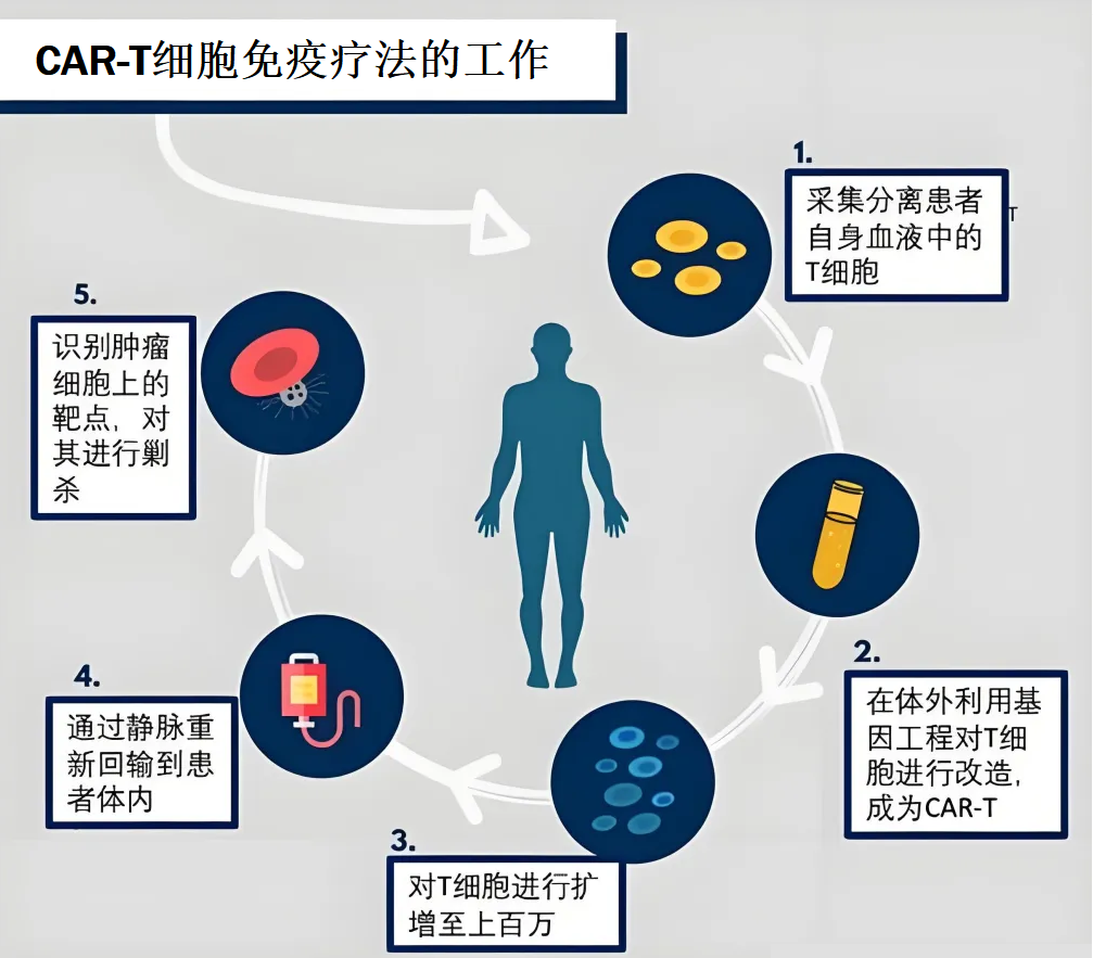 CAR-T细胞免疫疗法的工作流程