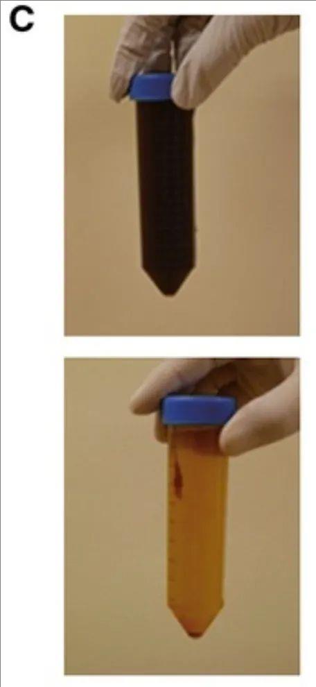 γδT细胞治疗胃癌恶性腹水的效果