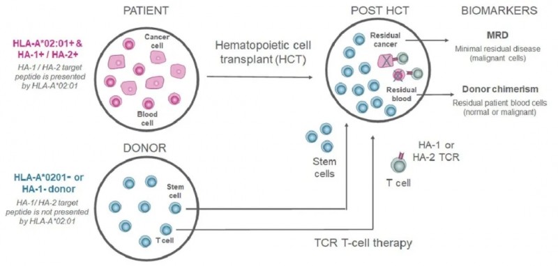TCR-T细胞疗法治疗骨髓转移的效果