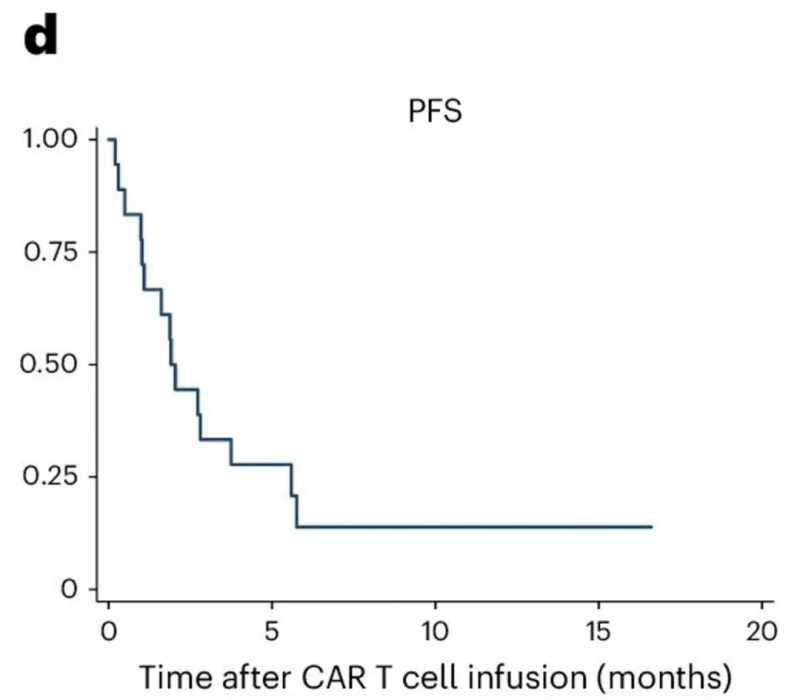 双靶点CART细胞疗法治疗胶质瘤的中位无进展生存期