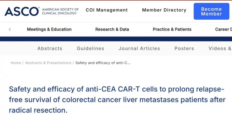 2025年ASCO大会报道CEA CAR-T