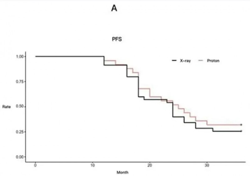 3年生存率涨30%!质子治疗成儿童肿瘤低伤害选择,规避传统放疗"伤敌一千自损八百"