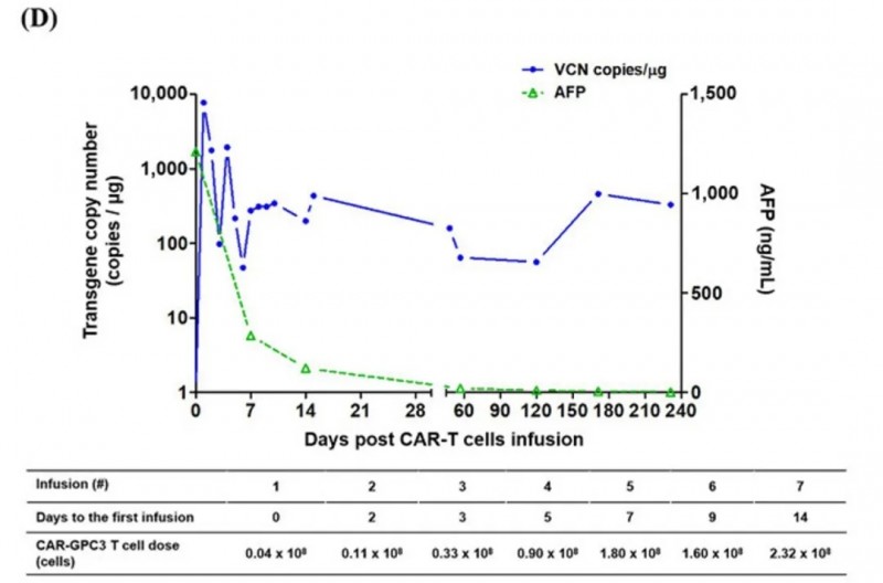 GPC3 CAR-T治疗肝癌的数据
