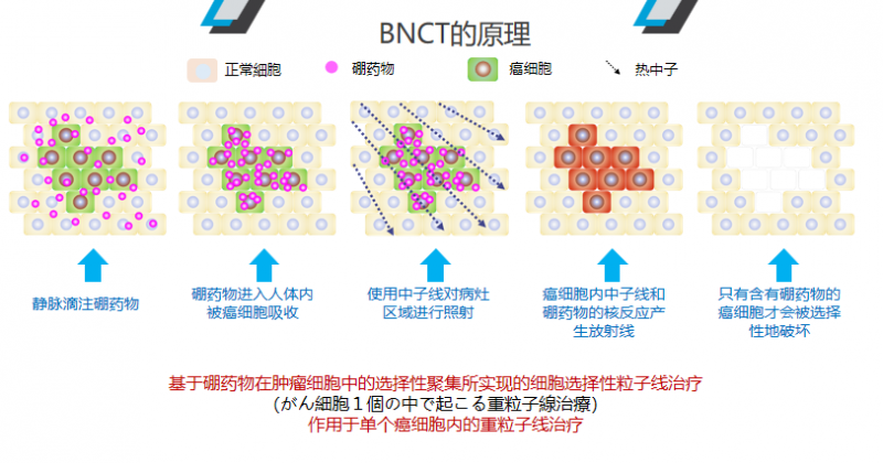 硼中子治疗的原理