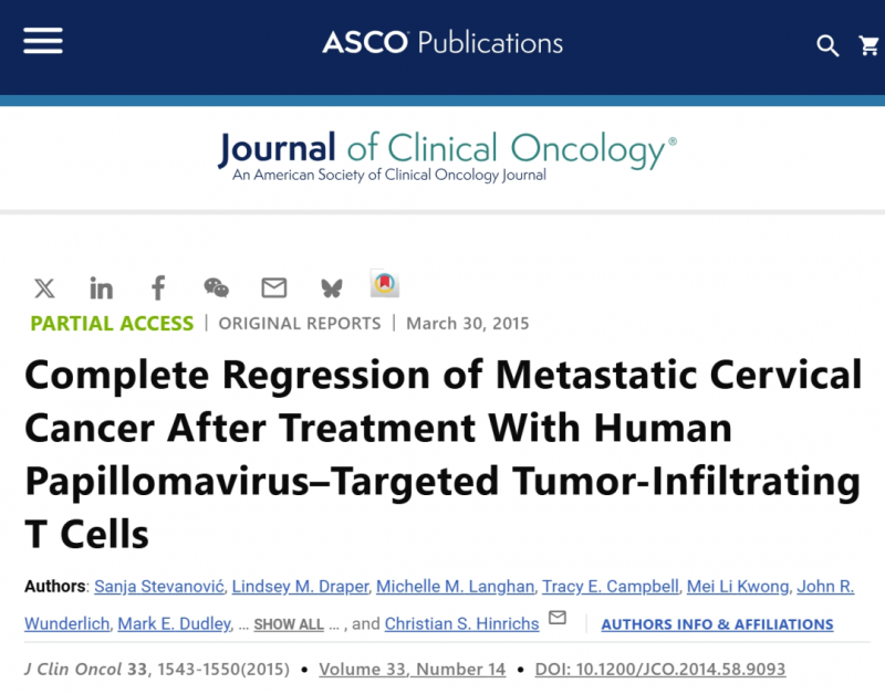 化疗难治宫颈癌不再坐以待毙!HPV-TILs疗法最长完全缓解