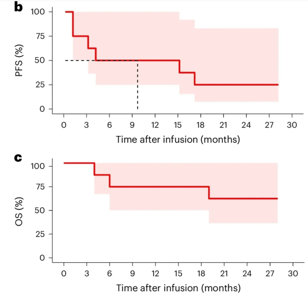 CD19-BBz CAR-NK细胞疗法治疗淋巴瘤的数据