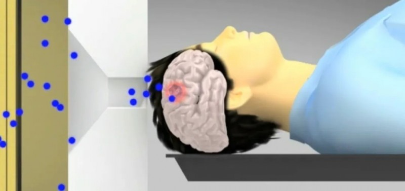 30分钟精准杀癌!中国首台硼中子俘获疗法正式落地,首例患者绝境重生