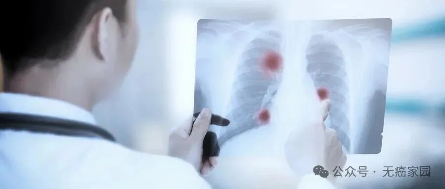 奥希替尼耐药不用怕！查出这种“MET扩增”，谷美替尼联合奥希替尼让肺癌患者生存期翻倍！