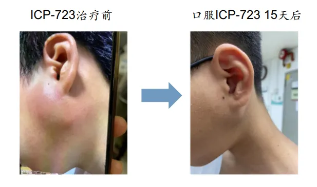 近90%患者肿瘤消退!革命性国研二代抗癌药上市!肺癌、肠癌、儿童肿瘤等全覆盖