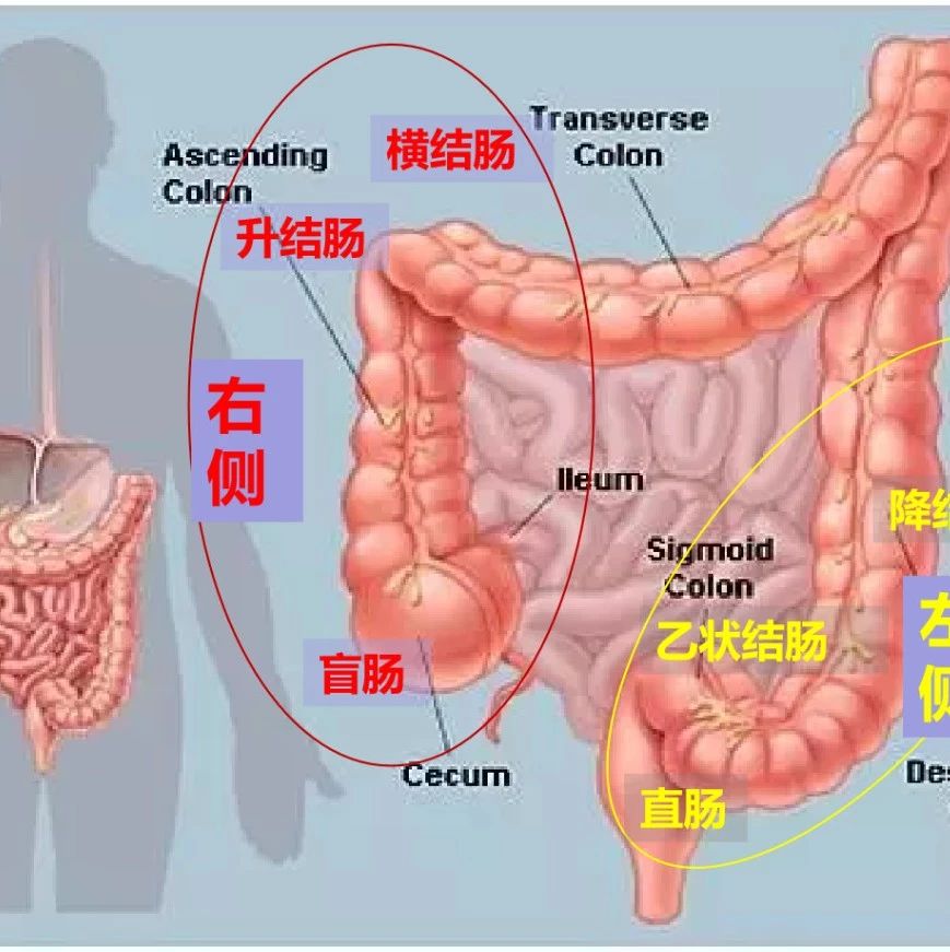 结直肠癌靶向药物,结直肠癌治疗方案,结直肠癌靶向治疗方案,结
