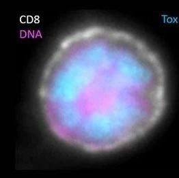 结直肠癌MSI(微卫星不稳定性)、MSS(微卫星稳定性)全面