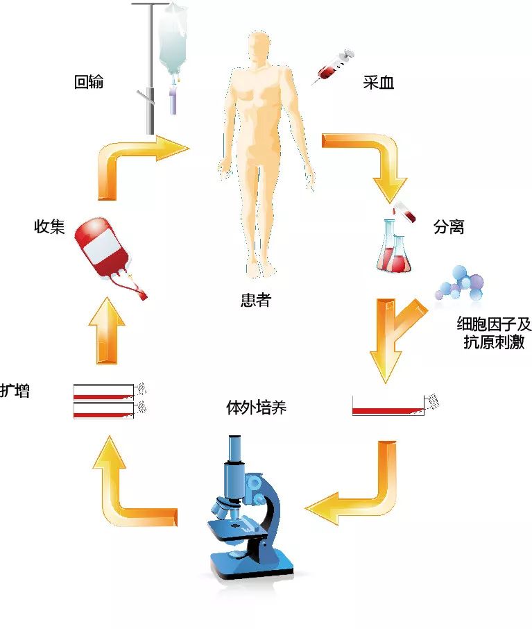 NK细胞疗法治疗流程