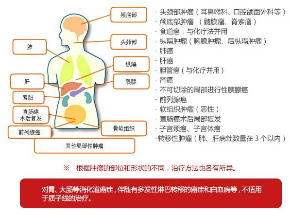 质子治疗适应症
