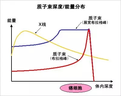 质子治疗和传统放疗放射剂量分布对比