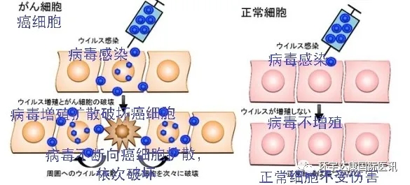 溶瘤病毒疗法治疗原理