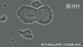 NK细胞攻击癌细胞 NK细胞攻击癌细胞