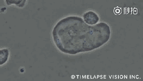 NK细胞瓦解癌细胞 NK细胞瓦解癌细胞