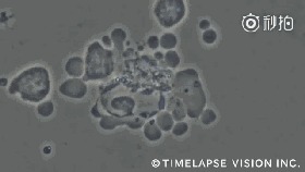 NK细胞消灭癌细胞 NK细胞消灭癌细胞