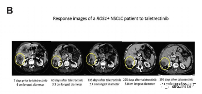 AB106治疗色瑞替尼耐药的效果 AB106治疗色瑞替尼耐药的效果