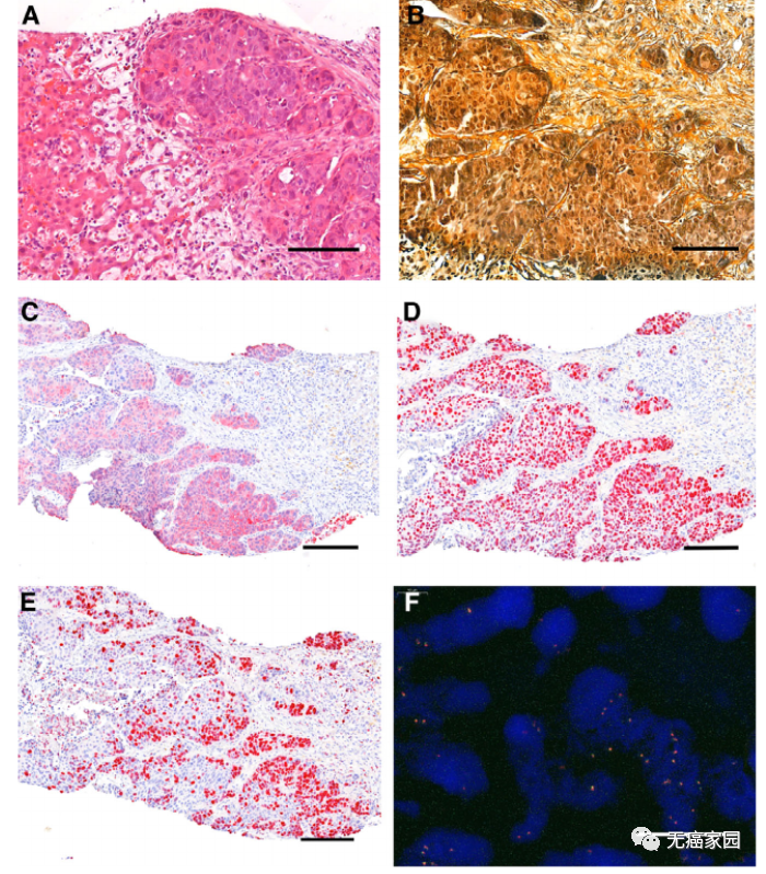 NTRK基因 NTRK基因