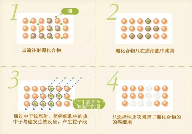 硼中子俘获治疗原理