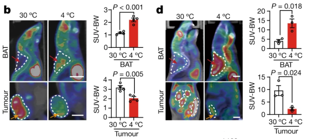 低温棕色脂肪对糖的消耗，肿瘤几乎摄取不到