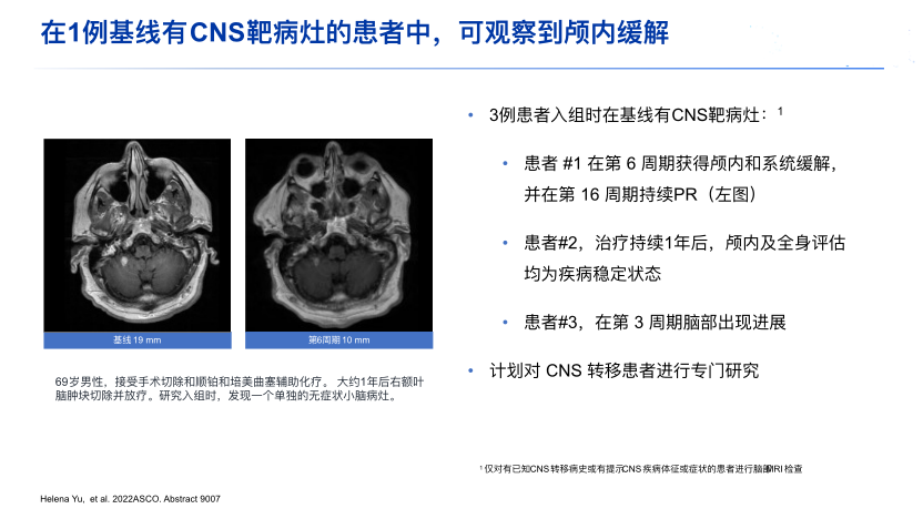 CLN-081治疗脑转移的案例