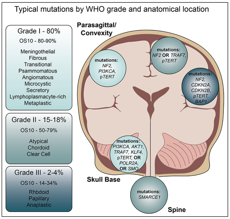 脑膜瘤分级