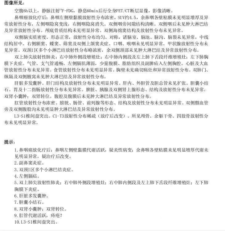 鼻咽癌质子治疗后的PETCT报告