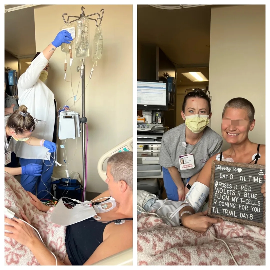 眼部黑色素瘤患者 眼部黑色素瘤患者