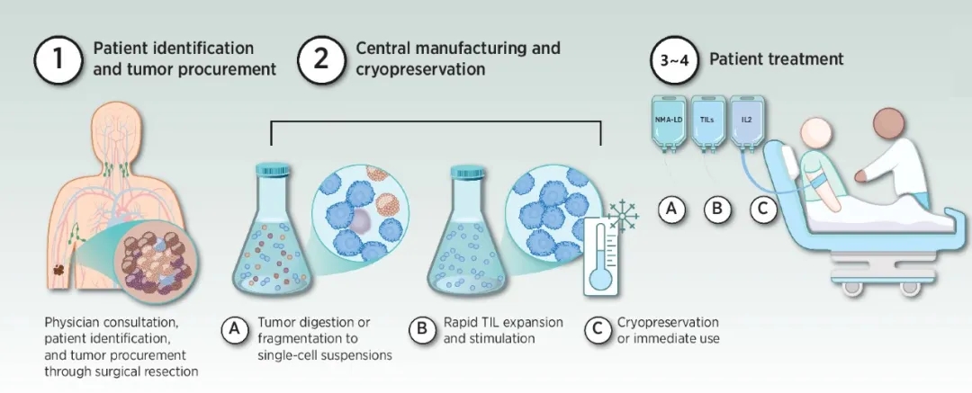 TIL疗法的主要治疗步骤 TIL疗法的主要治疗步骤