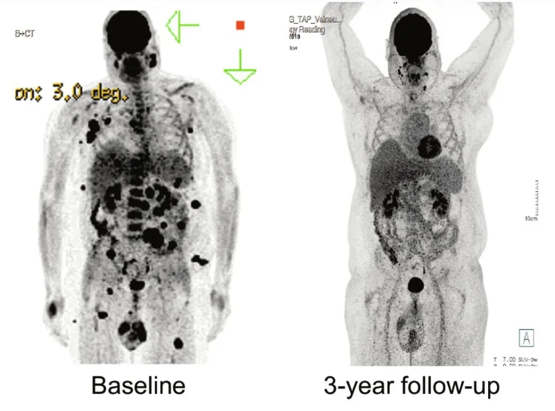 TIL-ACT疗效对比 TIL-ACT疗效对比
