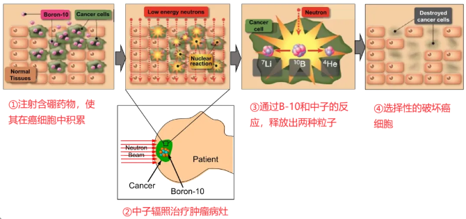 硼中子俘获治疗的原理