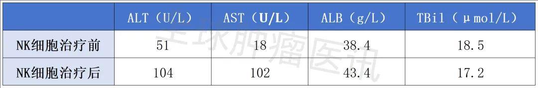 NK细胞治疗前后的肝功能变化