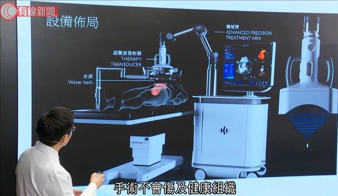 组织碎化术Histotripsy系统