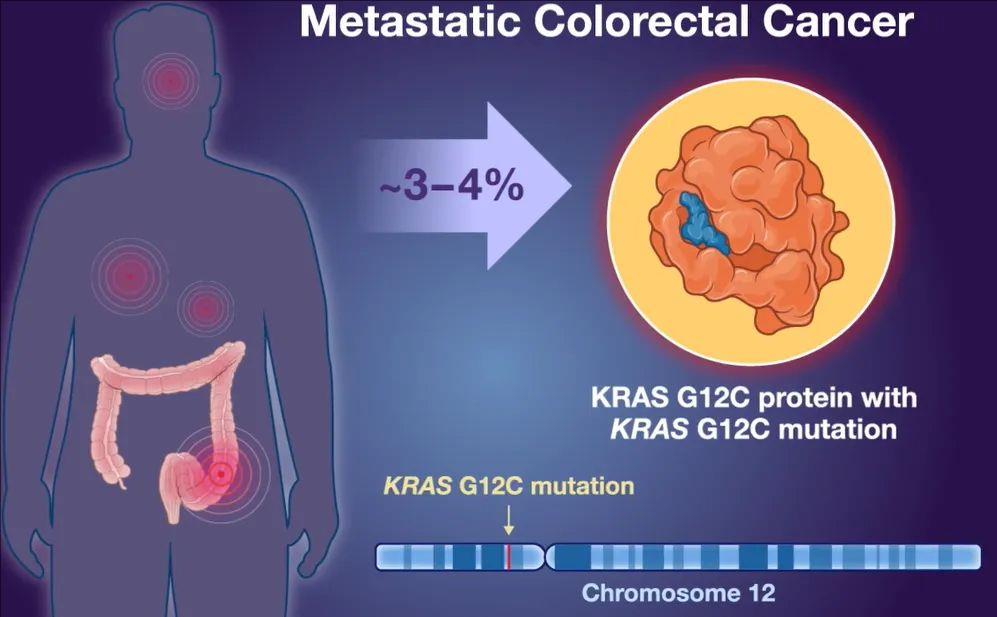 肠癌KRAS G12C基因突变