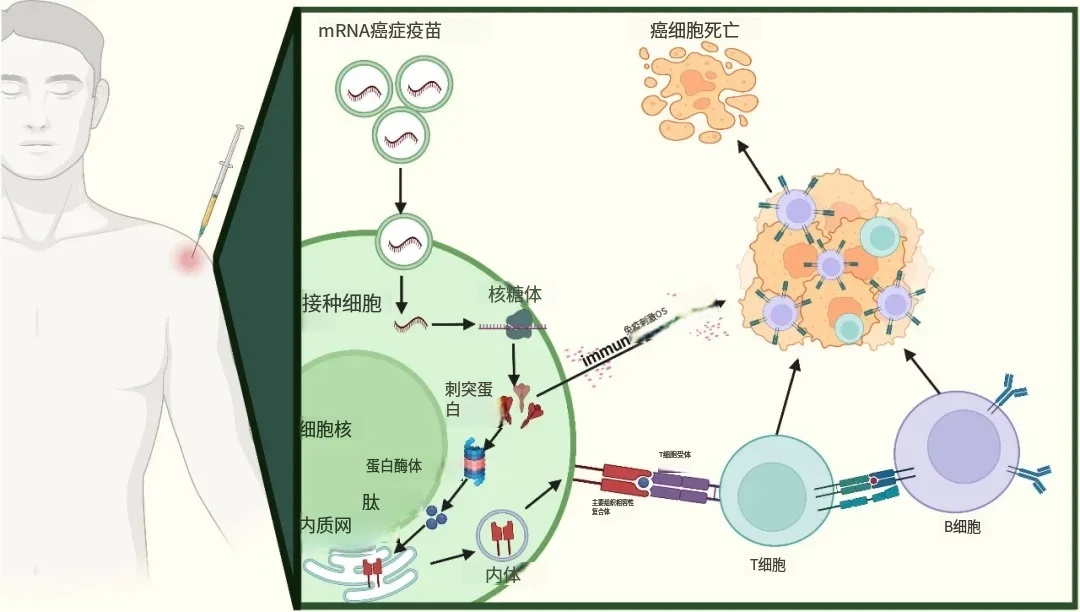 mRNA癌症疫苗的原理